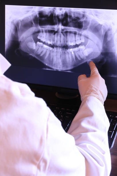 Best Dental Abscess Treatment in Borden, IN