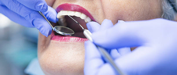 Best Emergency Treatment for Oral Infections in Borden, IN